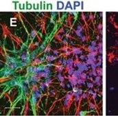Anti-Tubulin Antibody, beta III isoform, CT, clone TU-20 (Similar to TUJ1) ascites fluid, clone TU-20 (Similar to TUJ1), Chemicon&#174;