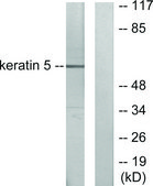 Anti-Keratin 5 antibody produced in rabbit affinity isolated antibody