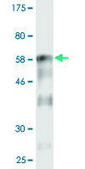 Monoclonal Anti-REN, (C-terminal) antibody produced in mouse clone 3B5, purified immunoglobulin, buffered aqueous solution