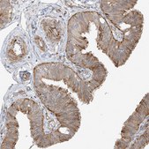 Anti-DCDC2 antibody produced in rabbit Prestige Antibodies&#174; Powered by Atlas Antibodies, affinity isolated antibody, buffered aqueous glycerol solution