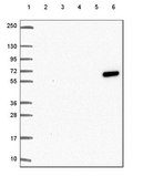 Anti-KRT6A antibody produced in rabbit Prestige Antibodies&#174; Powered by Atlas Antibodies, affinity isolated antibody, buffered aqueous glycerol solution
