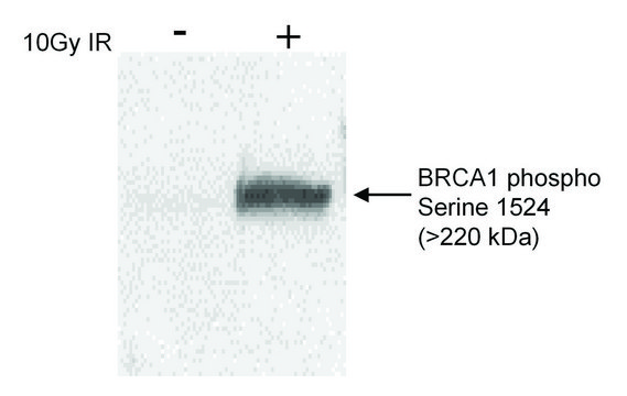 Rabbit anti-Phospho BRCA1 (S1524) Antibody, Affinity Purified