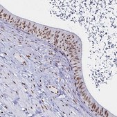 Anti-DDX39B antibody produced in rabbit Prestige Antibodies&#174; Powered by Atlas Antibodies, affinity isolated antibody