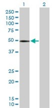 Anti-CHIT1 antibody produced in rabbit purified immunoglobulin, buffered aqueous solution