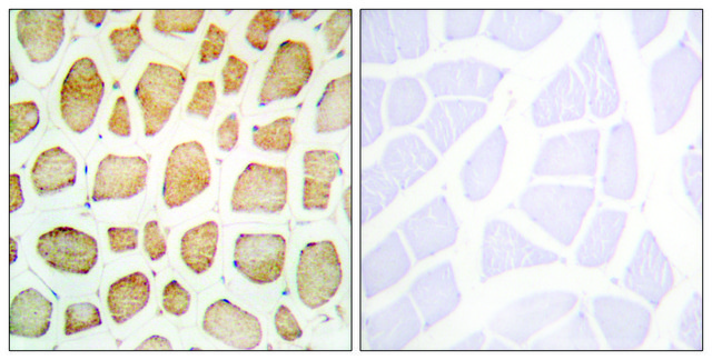 Anti-Actinin &#945; antibody produced in rabbit affinity isolated antibody