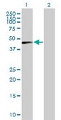 Anti-CTSD antibody produced in mouse purified immunoglobulin, buffered aqueous solution