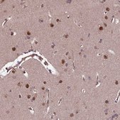 Anti-UBE3A antibody produced in rabbit affinity isolated antibody, buffered aqueous glycerol solution