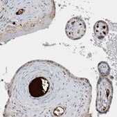 Anti-AFP antibody produced in rabbit Prestige Antibodies&#174; Powered by Atlas Antibodies, affinity isolated antibody, buffered aqueous glycerol solution