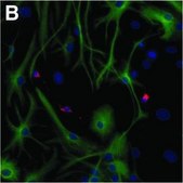 Monoclonal Anti-MAP2 antibody produced in mouse clone HM-2, ascites fluid
