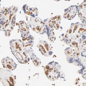 Anti-SPTB antibody produced in rabbit Ab2, Prestige Antibodies&#174; Powered by Atlas Antibodies, affinity isolated antibody, buffered aqueous glycerol solution
