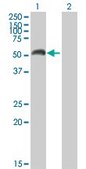 Anti-MAOA antibody produced in mouse IgG fraction of antiserum, buffered aqueous solution