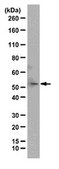 Anti-Tryptophan hydroxylase 2 Antibody from rabbit, purified by affinity chromatography