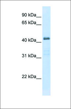 Anti-SLC29A2 antibody produced in rabbit affinity isolated antibody