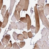Anti-MYLK2 antibody produced in rabbit Prestige Antibodies&#174; Powered by Atlas Antibodies, affinity isolated antibody, buffered aqueous glycerol solution