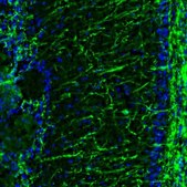 Anti-MBP antibody produced in rabbit Prestige Antibodies&#174; Powered by Atlas Antibodies, affinity isolated antibody, buffered aqueous glycerol solution