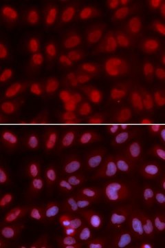 Anti-SIN3A antibody produced in rabbit