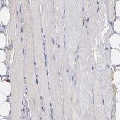 Anti-Anti-PTGS1 antibody produced in rabbit Prestige Antibodies&#174; Powered by Atlas Antibodies, affinity isolated antibody, buffered aqueous glycerol solution