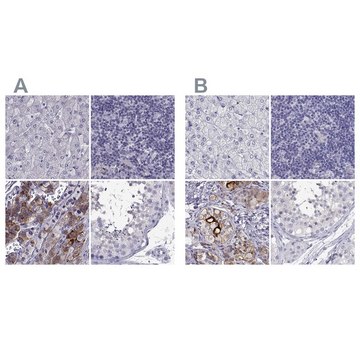 Anti-IGSF1 antibody produced in rabbit Prestige Antibodies&#174; Powered by Atlas Antibodies, affinity isolated antibody