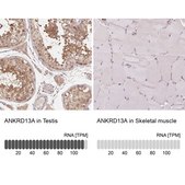 Anti-ANKRD13A antibody produced in rabbit Prestige Antibodies&#174; Powered by Atlas Antibodies, affinity isolated antibody, buffered aqueous glycerol solution