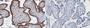 Anti-ATF6&#945; Antibody, clone 1F11 ZooMAb&#174; Rabbit Monoclonal recombinant, expressed in HEK 293 cells