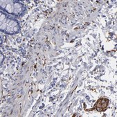 Anti-CADM3 antibody produced in rabbit Ab1, Prestige Antibodies&#174; Powered by Atlas Antibodies, affinity isolated antibody, buffered aqueous glycerol solution