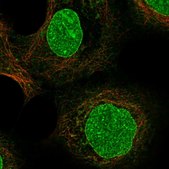 Anti-ZDHHC16 antibody produced in rabbit Prestige Antibodies&#174; Powered by Atlas Antibodies, affinity isolated antibody