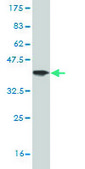 Monoclonal Anti-GATAD2B antibody produced in mouse clone 4G10, purified immunoglobulin, buffered aqueous solution