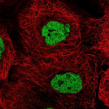 Anti-CSNK2A1 antibody produced in rabbit Prestige Antibodies&#174; Powered by Atlas Antibodies, affinity isolated antibody