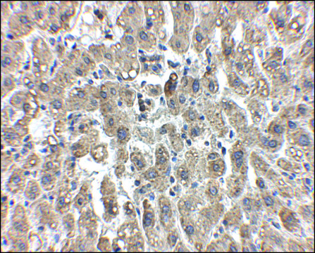 Anti-LDL-R antibody produced in chicken affinity isolated antibody, buffered aqueous solution