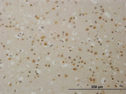 Monoclonal Anti-TBL1X antibody produced in mouse clone 2B6, purified immunoglobulin, buffered aqueous solution