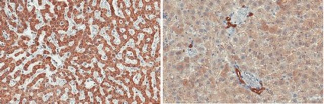 Anti-Retinal Dehydrogenase 1/ALDH1A1 Antibody, clone 16B4.2 clone 16B4.2, from mouse