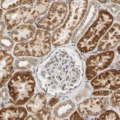 Anti-SFXN3 antibody produced in rabbit Prestige Antibodies&#174; Powered by Atlas Antibodies, affinity isolated antibody, buffered aqueous glycerol solution