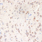 Anti-CYPOR antibody produced in rabbit