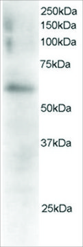 Anti-FGR antibody produced in goat affinity isolated antibody, buffered aqueous solution