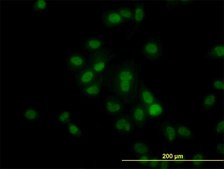 Monoclonal Anti-HDAC1 antibody produced in mouse clone 5C11, purified immunoglobulin, buffered aqueous solution