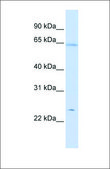 Anti-PRDX2 antibody produced in rabbit affinity isolated antibody