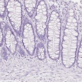 Anti-TGM1 antibody produced in rabbit Prestige Antibodies&#174; Powered by Atlas Antibodies, affinity isolated antibody, buffered aqueous glycerol solution