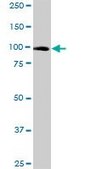 Anti-PLG antibody produced in mouse purified immunoglobulin, buffered aqueous solution