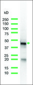 Anti-Keratin 17 antibody, Rabbit monoclonal recombinant, expressed in proprietary host, clone SP95, affinity isolated antibody