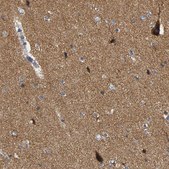 Anti-GDAP1 antibody produced in rabbit Prestige Antibodies&#174; Powered by Atlas Antibodies, affinity isolated antibody, buffered aqueous glycerol solution