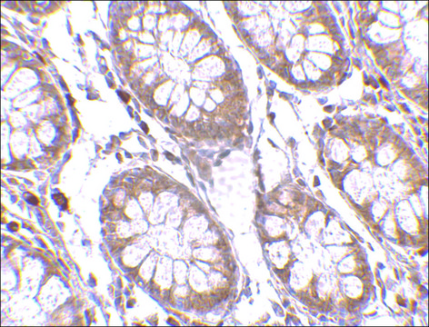 Anti-PTK7 antibody produced in rabbit affinity isolated antibody, buffered aqueous solution