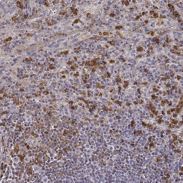 Anti-ZYX antibody produced in rabbit Prestige Antibodies&#174; Powered by Atlas Antibodies, affinity isolated antibody, buffered aqueous glycerol solution