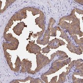 Anti-WDR72 antibody produced in rabbit Prestige Antibodies&#174; Powered by Atlas Antibodies, affinity isolated antibody, buffered aqueous glycerol solution