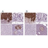 Anti-CHGB antibody produced in rabbit Prestige Antibodies&#174; Powered by Atlas Antibodies, affinity isolated antibody, buffered aqueous glycerol solution