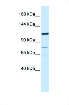 Anti-KIAA1324 antibody produced in rabbit affinity isolated antibody