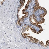 Anti-CD38 antibody produced in rabbit Prestige Antibodies&#174; Powered by Atlas Antibodies, affinity isolated antibody, buffered aqueous glycerol solution