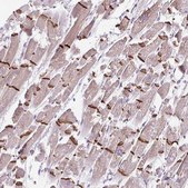 Anti-DSP antibody produced in rabbit Prestige Antibodies&#174; Powered by Atlas Antibodies, affinity isolated antibody, buffered aqueous glycerol solution