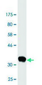 Monoclonal Anti-FKBP10 antibody produced in mouse clone 1C6, ascites fluid