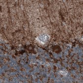Monoclonal Anti-GAD1 antibody produced in mouse Prestige Antibodies&#174; Powered by Atlas Antibodies, clone CL2914, purified immunoglobulin, buffered aqueous glycerol solution