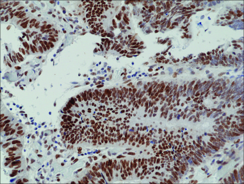 Anti-MSH6 antibody, Rabbit monoclonal recombinant, expressed in HEK 293 cells, clone RM376, purified immunoglobulin